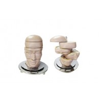 cabeça em disco corte axial